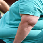 SES reforça importância da prevenção e do cuidado com a obesidade